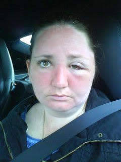 Travel Horror Stories When Travel Goes Wrong // Allergic Reaction Photo Girls Gospel